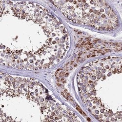 Invitrogen ZBTB39 Polyclonal Antibody 100 &mu;L; Unconjugated:Antibodies,