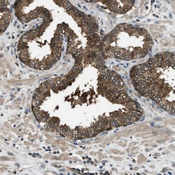 Invitrogen HEBP2 Polyclonal Antibody 100 &mu;L; Unconjugated:Antibodies,