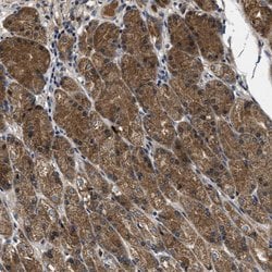 GALK1 Polyclonal Antibody:Antibodies, Polyclonal