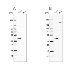 GALK1 Polyclonal Antibody:Antibodies, Polyclonal