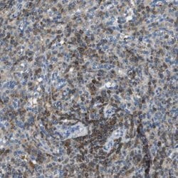 Invitrogen RIAM Polyclonal Antibody 100 &mu;L; Unconjugated:Antibodies,