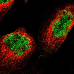 Invitrogen GATAD2B Polyclonal Antibody 100 &mu;L; Unconjugated:Antibodies,