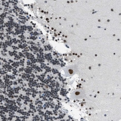 Invitrogen GATAD2B Polyclonal Antibody 100 &mu;L; Unconjugated:Antibodies,
