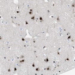 Invitrogen GATAD2B Polyclonal Antibody 100 &mu;L; Unconjugated:Antibodies,