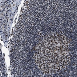 Invitrogen GATAD2B Polyclonal Antibody 100 &mu;L; Unconjugated:Antibodies,