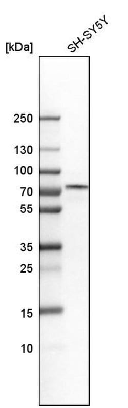 Invitrogen GATAD2B Polyclonal Antibody 100 &mu;L; Unconjugated:Antibodies,