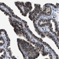 Invitrogen LTA4H Polyclonal Antibody 100 &mu;L; Unconjugated:Antibodies,