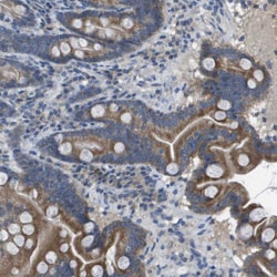 Invitrogen CLCA4 Polyclonal Antibody 100 &mu;L; Unconjugated:Antibodies,