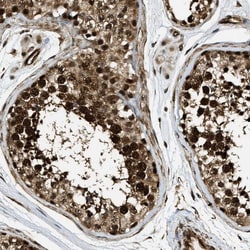 Invitrogen CCDC104 Polyclonal Antibody 100 &mu;L; Unconjugated:Antibodies,