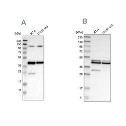 Invitrogen CCDC104 Polyclonal Antibody 100 &mu;L; Unconjugated:Antibodies,