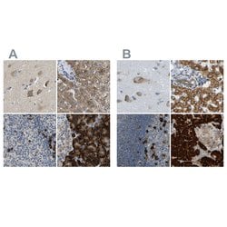 Invitrogen TRAP alpha Polyclonal Antibody 100 &mu;L; Unconjugated:Antibodies,
