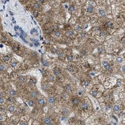 Invitrogen TRAP alpha Polyclonal Antibody 100 &mu;L; Unconjugated:Antibodies,