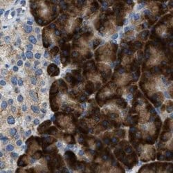 Invitrogen TRAP alpha Polyclonal Antibody 100 &mu;L; Unconjugated:Antibodies,