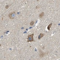 Invitrogen TRAP alpha Polyclonal Antibody 100 &mu;L; Unconjugated:Antibodies,