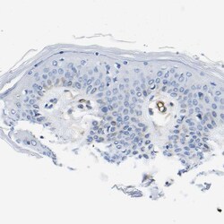 Invitrogen Dysferlin Polyclonal Antibody 100 &mu;L; Unconjugated:Antibodies,