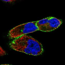 Invitrogen Dysferlin Polyclonal Antibody 100 &mu;L; Unconjugated:Antibodies,