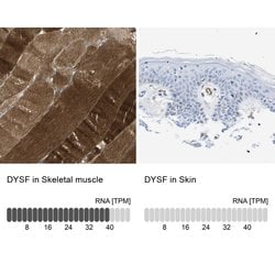 Invitrogen Dysferlin Polyclonal Antibody 100 &mu;L; Unconjugated:Antibodies,