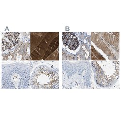 Invitrogen Dysferlin Polyclonal Antibody 100 &mu;L; Unconjugated:Antibodies,