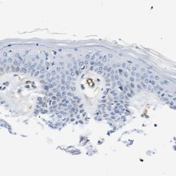 Invitrogen Dysferlin Polyclonal Antibody 100 &mu;L; Unconjugated:Antibodies,