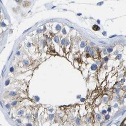 Invitrogen Dysferlin Polyclonal Antibody 100 &mu;L; Unconjugated:Antibodies,