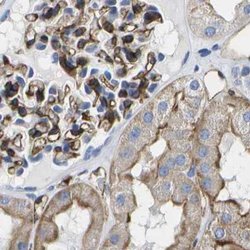 Invitrogen Dysferlin Polyclonal Antibody 100 &mu;L; Unconjugated:Antibodies,