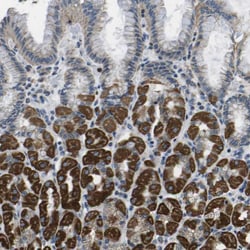 Invitrogen GALNT15 Polyclonal Antibody 100 &mu;L; Unconjugated:Antibodies,