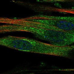 Invitrogen GALNT15 Polyclonal Antibody 100 &mu;L; Unconjugated:Antibodies,