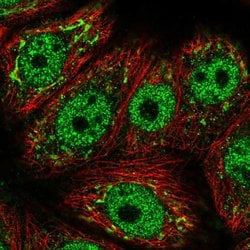 GALNT6 Polyclonal Antibody:Antibodies, Polyclonal
