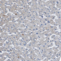 GALNT6 Polyclonal Antibody:Antibodies, Polyclonal