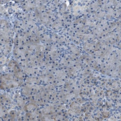 GALNT6 Polyclonal Antibody:Antibodies, Polyclonal