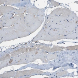 GALNT6 Polyclonal Antibody:Antibodies, Polyclonal