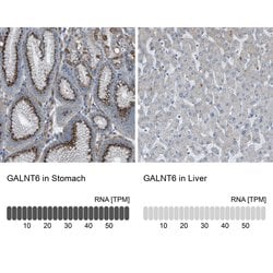 GALNT6 Polyclonal Antibody:Antibodies, Polyclonal