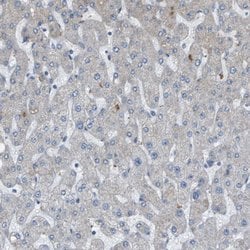 GALNT6 Polyclonal Antibody:Antibodies, Polyclonal
