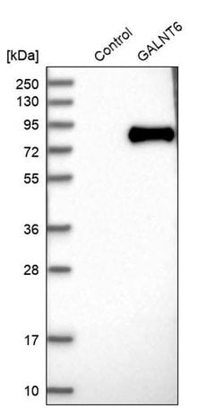 GALNT6 Polyclonal Antibody:Antibodies, Polyclonal