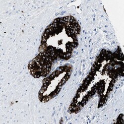 Invitrogen CMTM1 Polyclonal Antibody 100 &mu;L; Unconjugated:Antibodies,