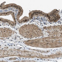 Invitrogen MED21 Polyclonal Antibody 100 &mu;L; Unconjugated:Antibodies,