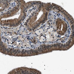 Invitrogen GINM1 Polyclonal Antibody 100 &mu;L | Buy Online | Invitrogen&trade; | Fisher Scientific