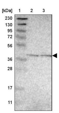 Invitrogen GINM1 Polyclonal Antibody 100 &mu;L | Buy Online | Invitrogen&trade; | Fisher Scientific