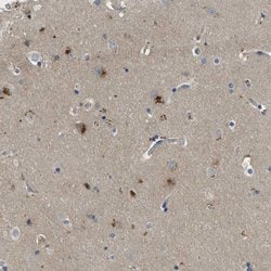 Invitrogen MAN2A2 Polyclonal Antibody 100 &mu;L; Unconjugated:Antibodies,
