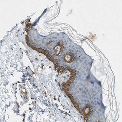 Invitrogen MAN2A2 Polyclonal Antibody 100 &mu;L; Unconjugated:Antibodies,
