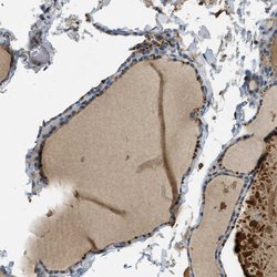 Invitrogen MAN2A2 Polyclonal Antibody 100 &mu;L; Unconjugated:Antibodies,