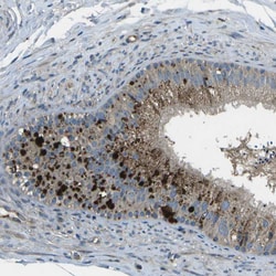 Invitrogen ACPL2 Polyclonal Antibody 100 &mu;L; Unconjugated:Antibodies,