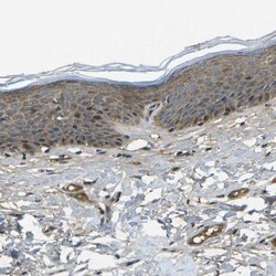 Invitrogen ACPL2 Polyclonal Antibody 100 &mu;L; Unconjugated:Antibodies,
