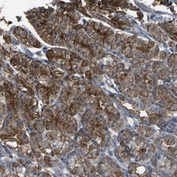 Invitrogen CYP4F11 Polyclonal Antibody 100 &mu;L; Unconjugated:Antibodies,
