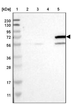 Invitrogen CYP4F11 Polyclonal Antibody 100 &mu;L; Unconjugated:Antibodies,