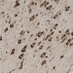 Invitrogen ST3GAL2 Polyclonal Antibody 100 &mu;L; Unconjugated:Antibodies,