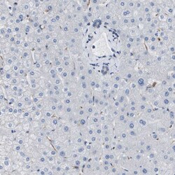 Invitrogen ST3GAL2 Polyclonal Antibody 100 &mu;L; Unconjugated:Antibodies,