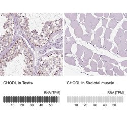 Invitrogen Chondrolectin Polyclonal Antibody 100 &mu;L; Unconjugated:Antibodies,