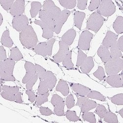 Invitrogen Chondrolectin Polyclonal Antibody 100 &mu;L; Unconjugated:Antibodies,