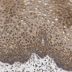 Invitrogen STRN Polyclonal Antibody 100 &mu;L; Unconjugated:Antibodies,